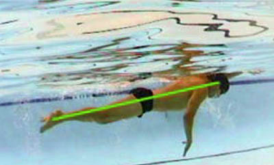 úszás hatása a test skoliozis látására