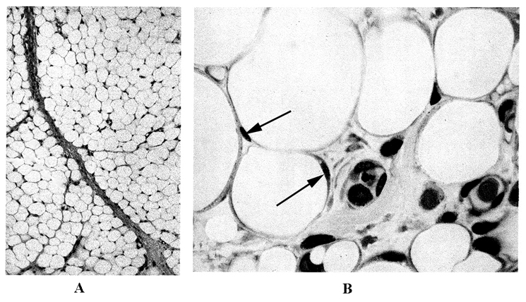 A zsírszövet kis (A) és nagy nagyítású (B) képe